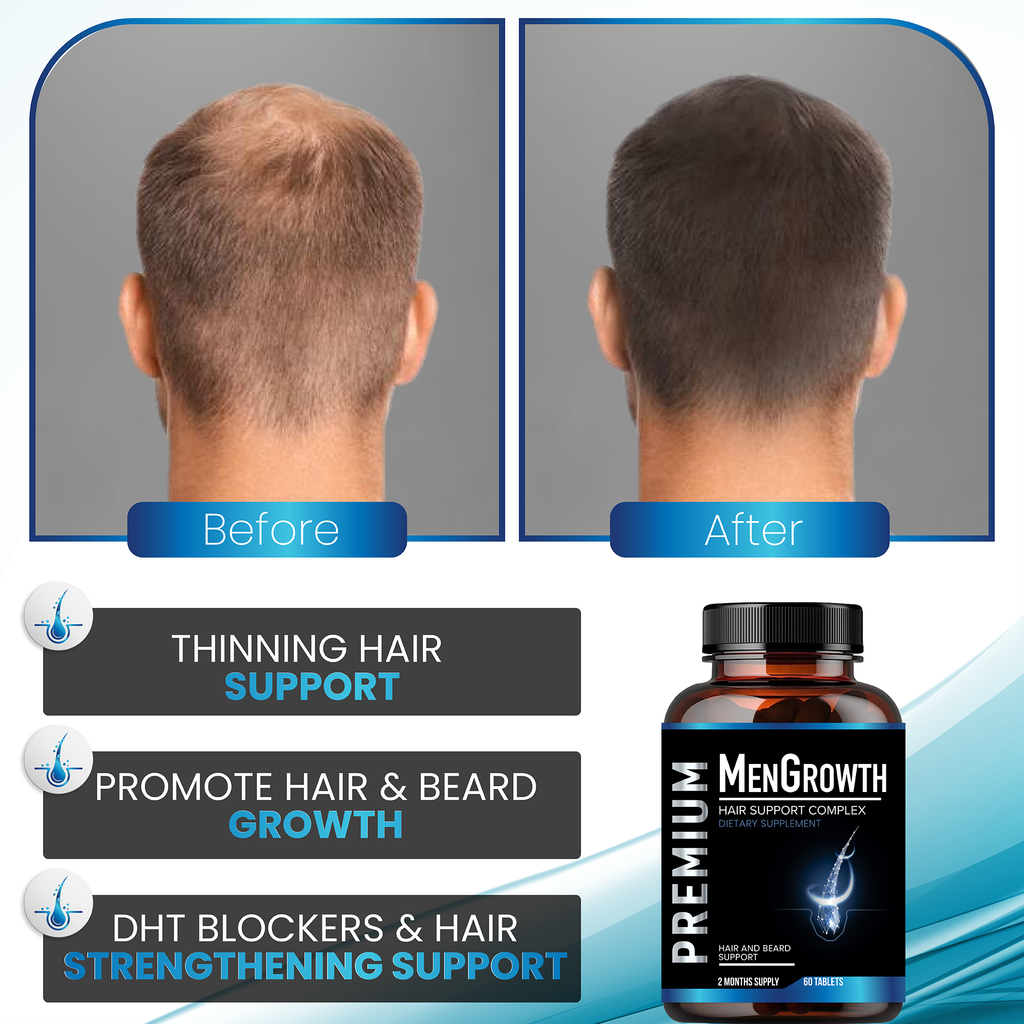 Mens Hair Growth-Hair Vitamins For Men. Anti Hair Loss Supplement, Regrow Hair & Beard